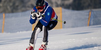 Ochroniarze prezydenta dorobili się bolesnej kontuzji?