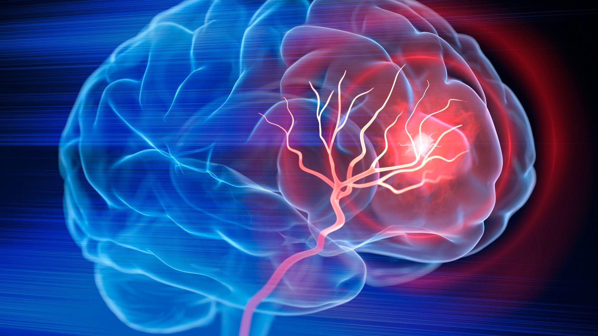 Pomáha už niekoľko minút cvičenia (ilustračné foto).