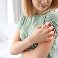 Ekcémás, és folyton viszket a bőre? Így csökkentheti az irritációt