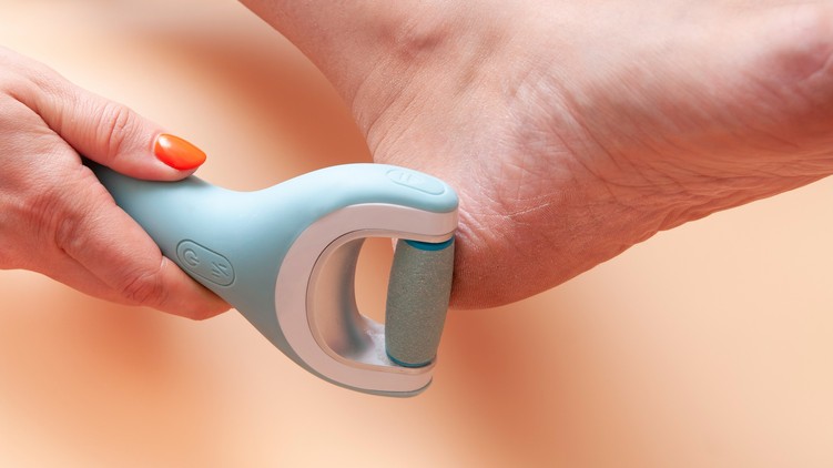 hiperkeratosis szemölcs, bőrkeményedés, ekcéma, ellen