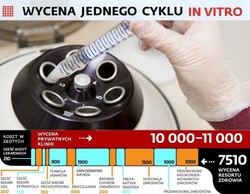 Refundacja in vitro: resort bada ceny na rynku