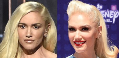 Co się dzieje z twarzą Gwen Stefani?