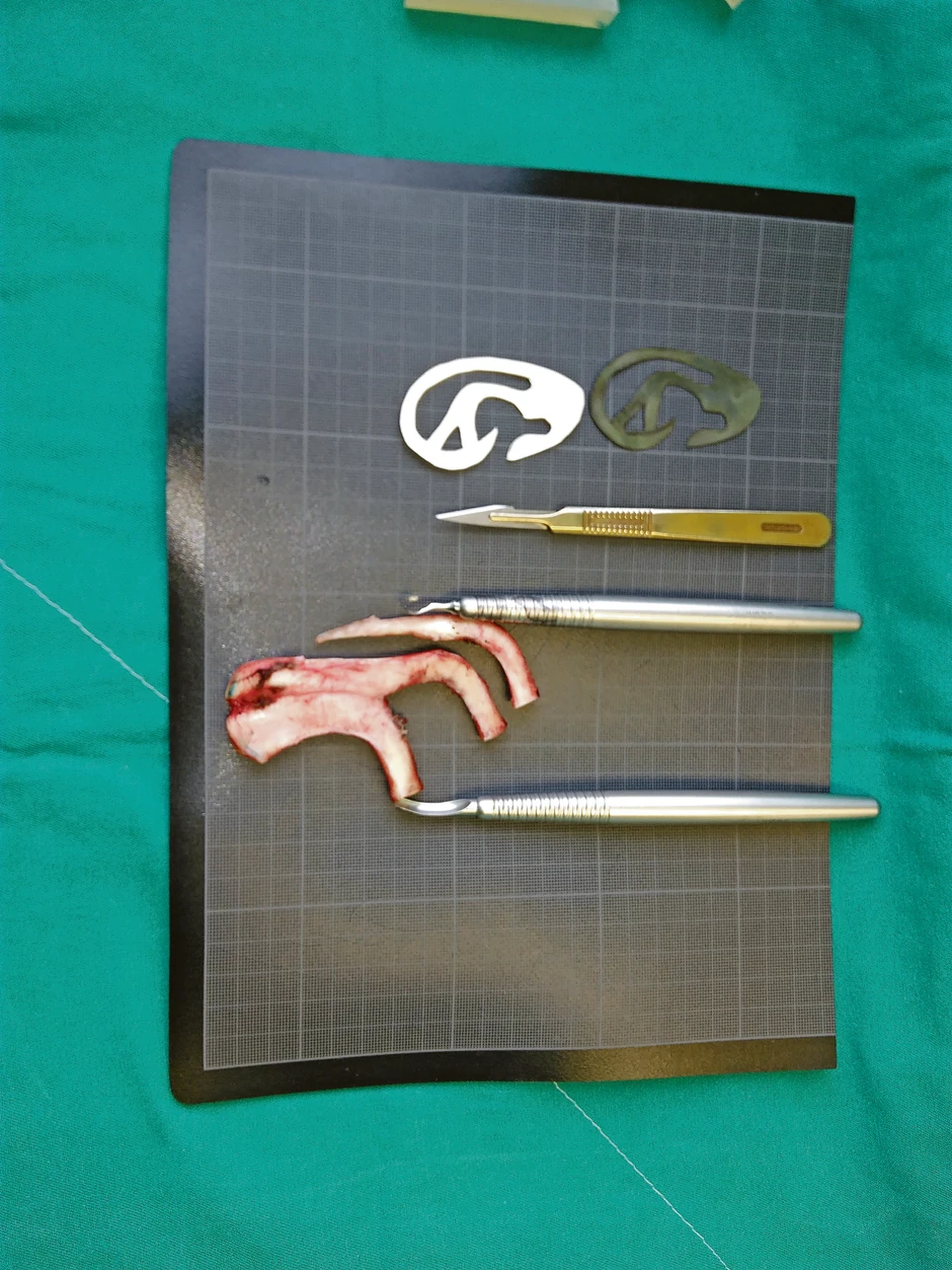 Rebarna hrskavica spremna za oblikovanje