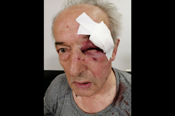 UHAPŠEN MUŠKARAC KOJI JE PRETUKAO GENERALA U PENZIJI Novi detalji brutalnog napada na autobuskoj stanici na Voždovcu: Određeno mu zadržavanje (FOTO)