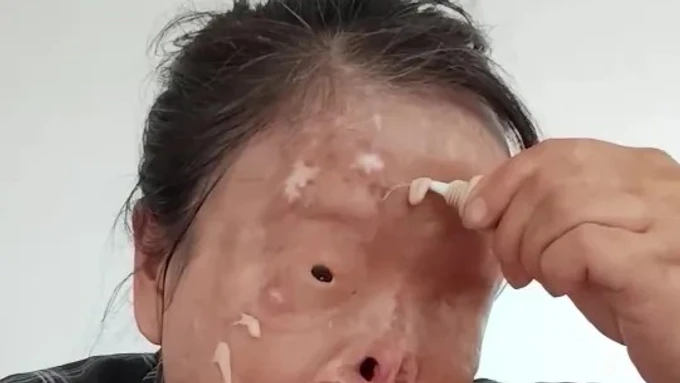 Pobegla od muža NASILNIKA, ali je uspeo da je nađe i UNAKAZI ZA CEO ŽIVOT - polio je kiselinom i od tad je njeno lice CRTEŽ PO SEĆANJU