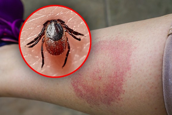 (VIDEO) STIŽE VIKEND I 25 U PLUSU, A SA TIM I OVA OPASNOST Doktorka Hitne pomoći o opasnosti iz trave: Jednu stvar NIKAKO ne smete da uradite