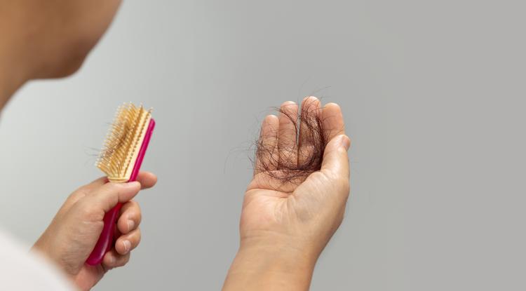 Ezt teheted a menopauza utáni hajhullás ellen. Fotó: Getty Images