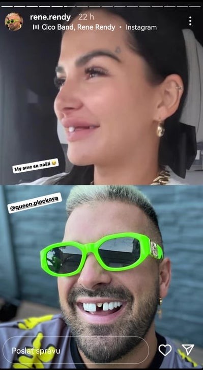 Zuzana Plačková musela navštíviť zubára. Jej manžel René mal z toho zábavu.