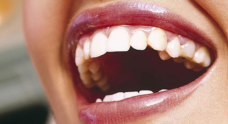 12 Things Your Dentist Knows About You Just By Looking in Your Mouth 