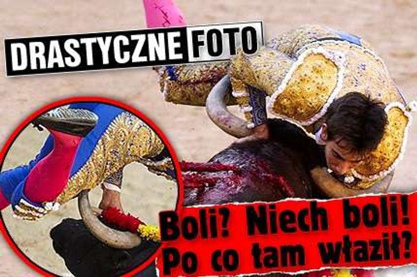 Boli? Niech boli! Po co tam właził? DRASTYCZNE FOTO