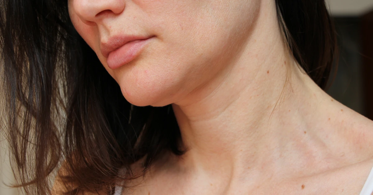 Czy kolagen to cudowny środek na zmarszczki i co naprawdę pomaga zachować młody wygląd?