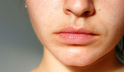 Jak usunąć lub rozjaśnić wąsik? Wypróbuj te domowe sposoby