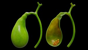 Žučna kesa je mali organ u obliku kruške 