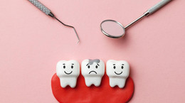 Próchnica zębów jako skutek działania bakterii