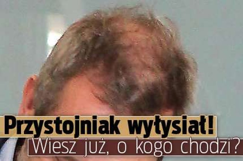 Przystojniak wyłysiał! Wiesz już, o kogo chodzi?