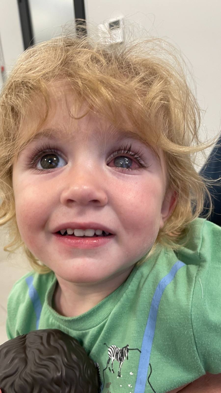 Choroba sa na Juwona mohla preniesť bozkom.