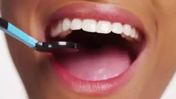 5 ways to naturally whiten your teeth at home - Vimarsana News