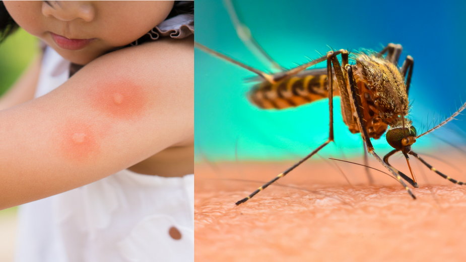 Zaskakujący sposób na odstraszenie komarów