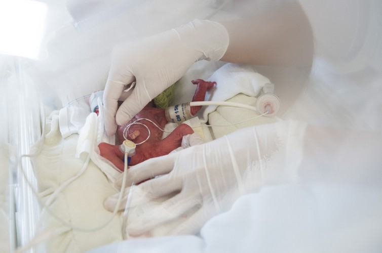 DZIEŃ WCZEŚNIAKA. Mali wojownicy w szpitalu Jósa András w mieście Nyíregyháza na Węgrzech