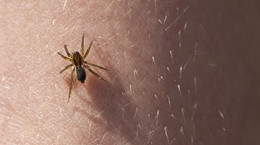 Ugryzienie pająka - charakterystyczne objawy