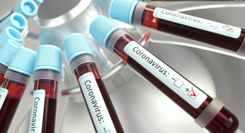 Coronavirus: Ghana’s COVID-19 case count shoots up to 566