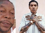Vybz Kartel opens up about struggle with Graves' disease causing facial swelling