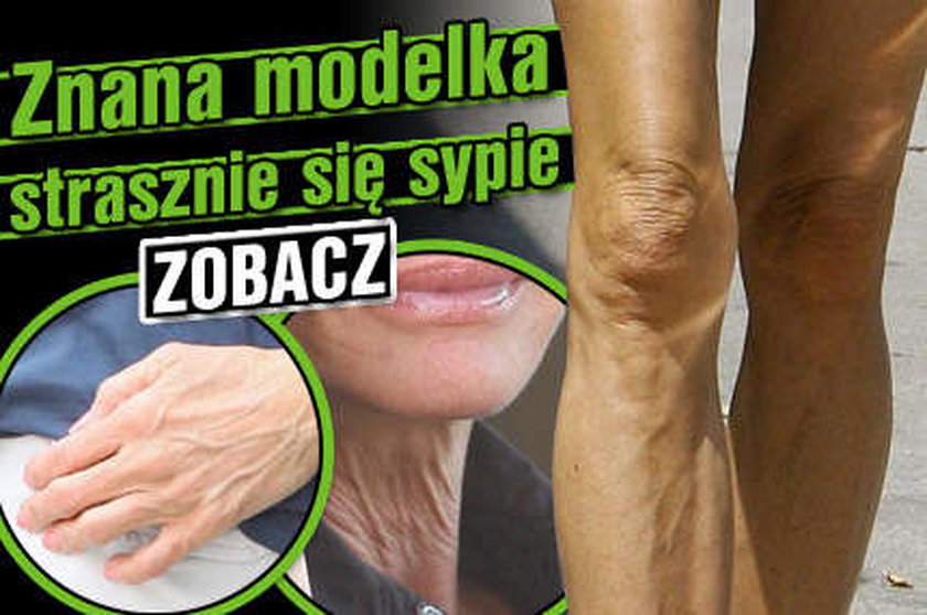 Znana modelka strasznie się sypie. ZOBACZ