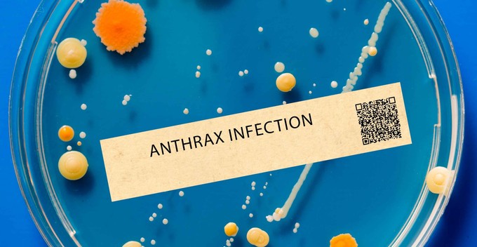 Anthrax (lépfene)