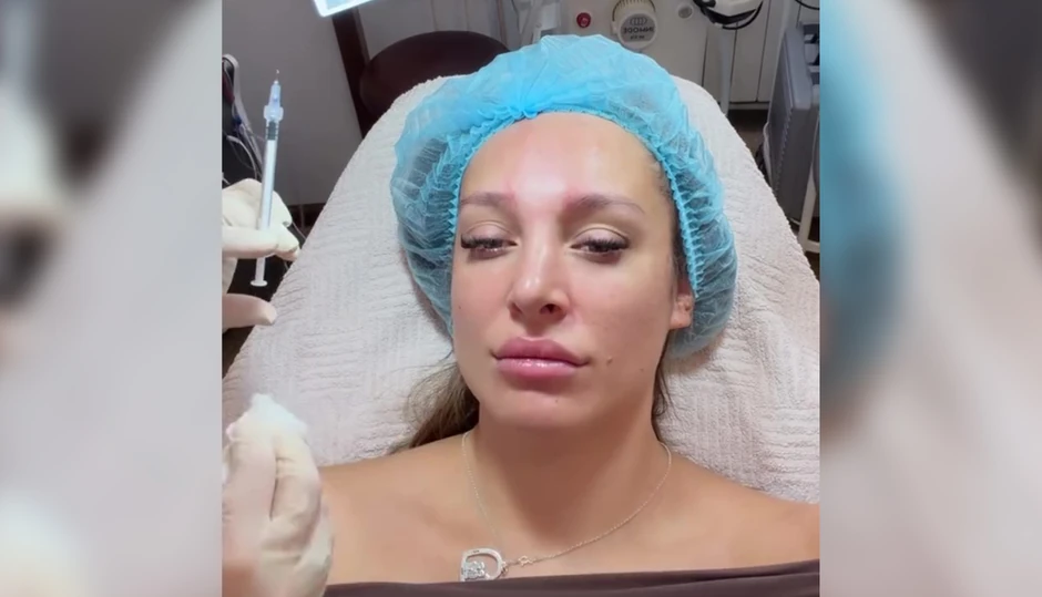 Luna Đogani ubrizgava botoks u lice, snimala se tokom tretmana