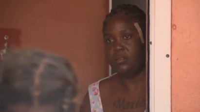 Sokkoló: egy sebtapasszal küldtek haza egy nőt az orvosok, holott egy lövedék maradt a fejében – videó