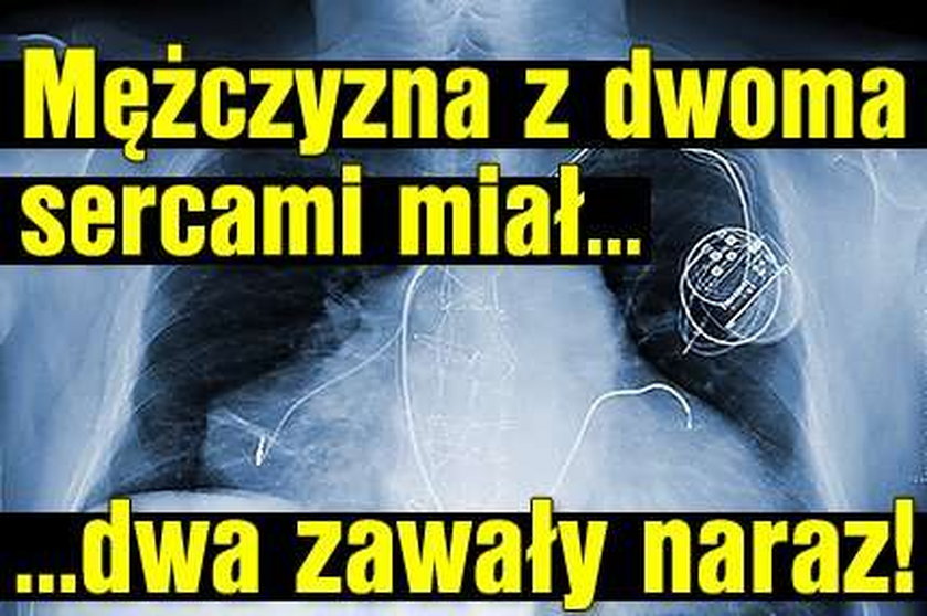 Mężczyzna z dwoma sercami miał... dwa zawały naraz!