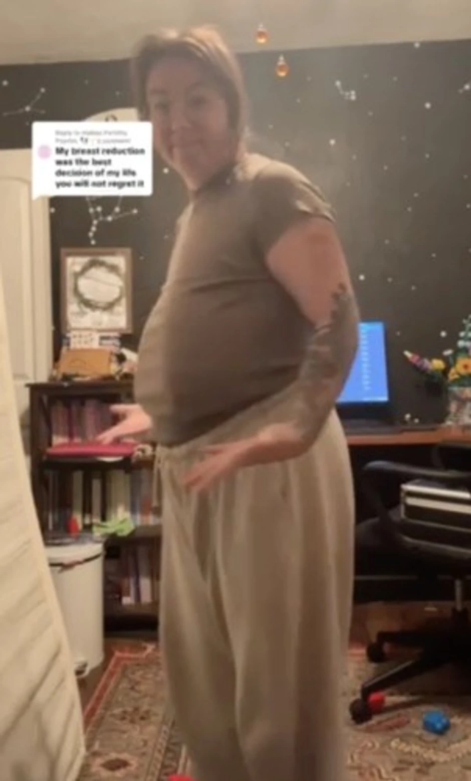 Žena morala da smanji grudi