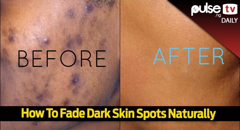 How To Fade Dark Spots Naturally (Pulse)