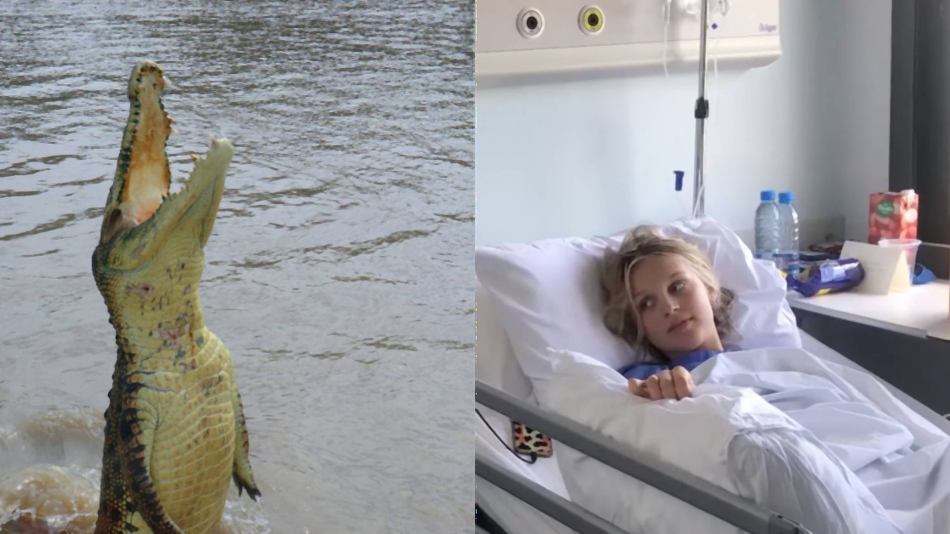 Tínedžerka zázrakom prežila útok krokodíla počas raftovania. Zachránili ju kamaráti, ktorí ho udierali do hlavy