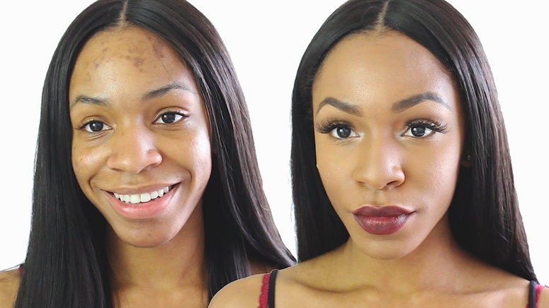 Diy How To Clear Facial Dark Spots With Aloe Vera Pulse Nigeria