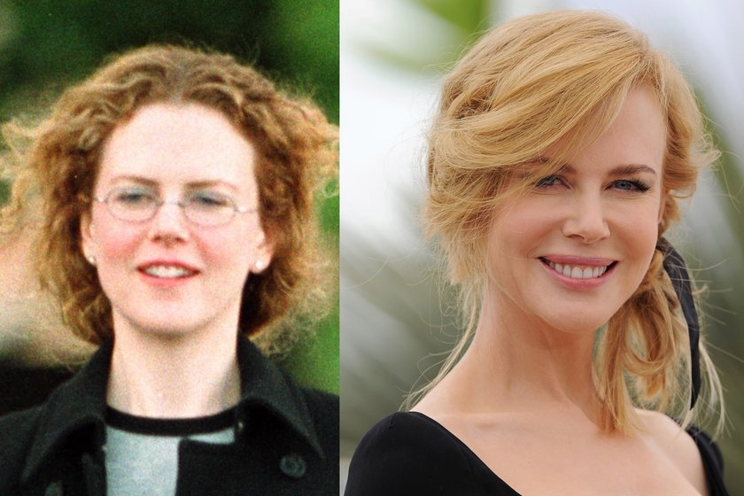 Nicole Kidman