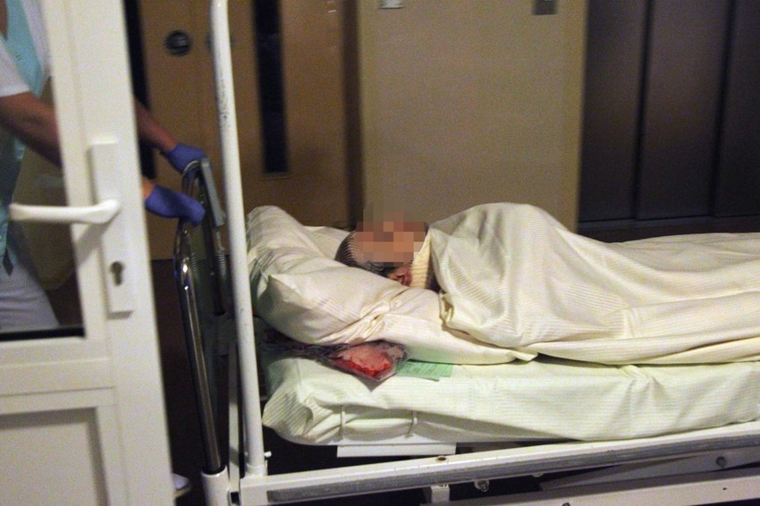 Nesrećni radnik u bolnici (FOTO: Fakt.pl)