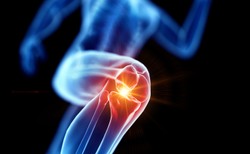 Problem z rzepką – co robić kiedy „chrupie” nam w kolanach?