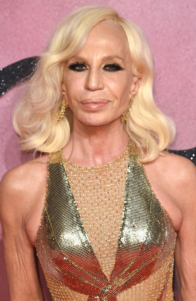 Ofiary operacji plastycznych: Donatella Versace