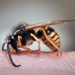 Darázscsípés allergia: mikor jelentkeznek a tünetek és meddig tartanak?