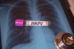 Wirus hMPV jest już u sąsiadów Polski. GIS wydał komunikat