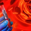 Hemoglobin je protein u crvenim krvnim zrncima koji prenosi kiseonik od pluća do ostatka tela