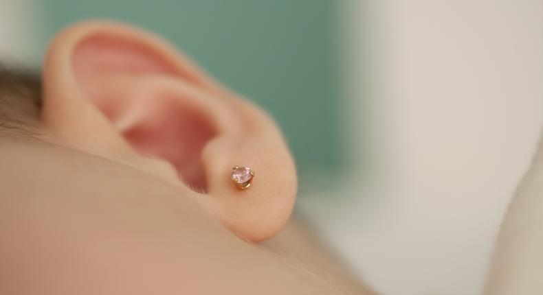Dr. P Extracts A 'Little Ear Piercing' Blackhead