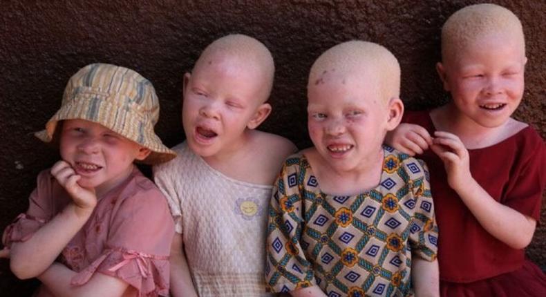 Albinos