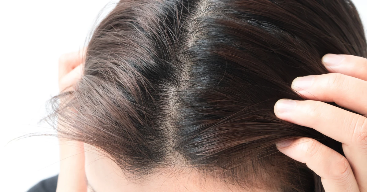 Domowa maseczka, która uratuje zniszczone i suche włosy. Tylko 2 sekretne składniki z kuchni