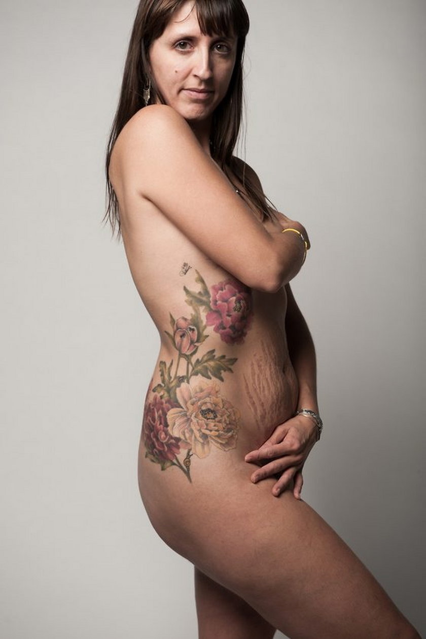Ciało po ciąży