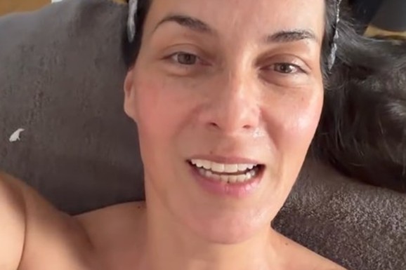 NAJLEPŠA SRPSKA VODITELJKA POKAZALA LICE BEZ TRUNKE ŠMINKE Marija Kilibarda zumira svaki detalj, neće da ulepšava stvarnost: "Tretman mi je preko potreban" (FOTO)
