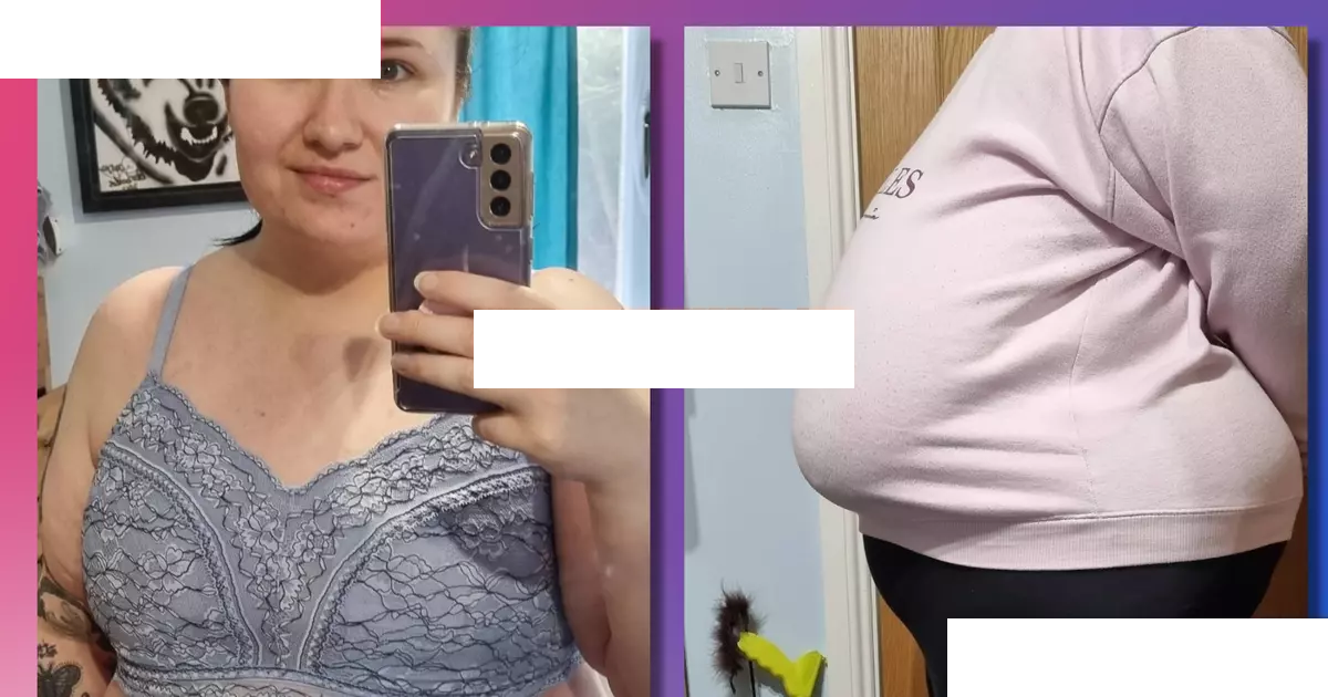 My size P boobs ruined my life - now I've dropped 21 cup sizes and
