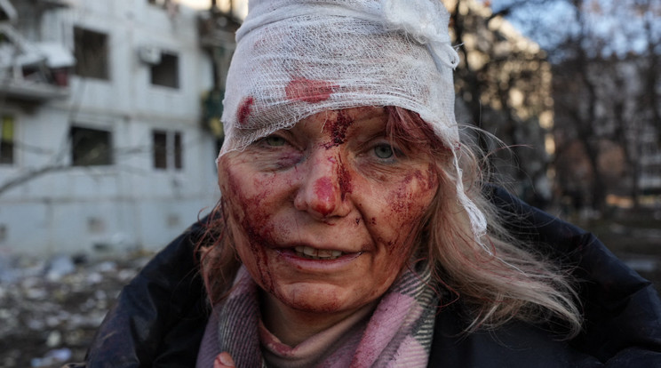 Sebesült nő Harkivban az orosz támadás után / Fotó: AFP