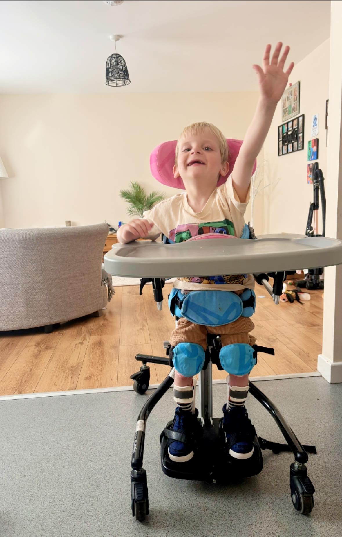 Myles Hughes (6) trpí vzácnym ochorením. 